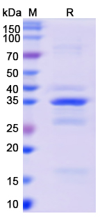[Proteogenix] Recombinant Monkeypox virus/MPXV A26L Protein, N-GST & C-His