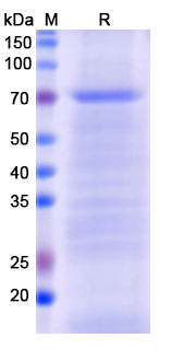 [Proteogenix] Recombinant Monkeypox virus/MPXV C18L Protein, N-His