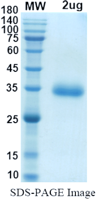 [Proteogenix] SARS-CoV-2 RBD of Spike protein, S477N – lineage B.1.526 – NY Iota Variant