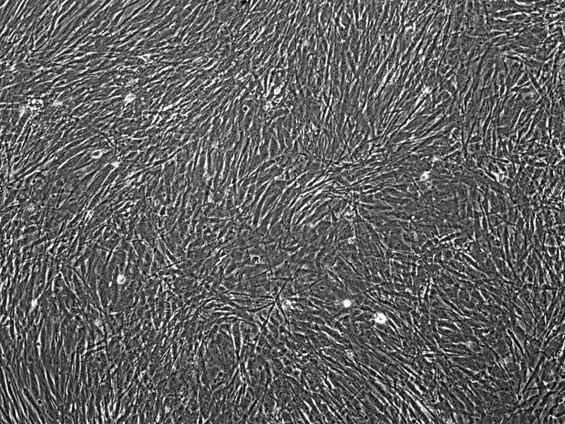 [Vitro Biopharma] Human Lung Fibroblasts: 1,000,000 Cells