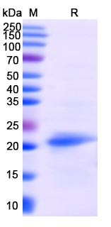 [Proteogenix] IFNB1 / IFN-beta, N-His, recombinant protein
