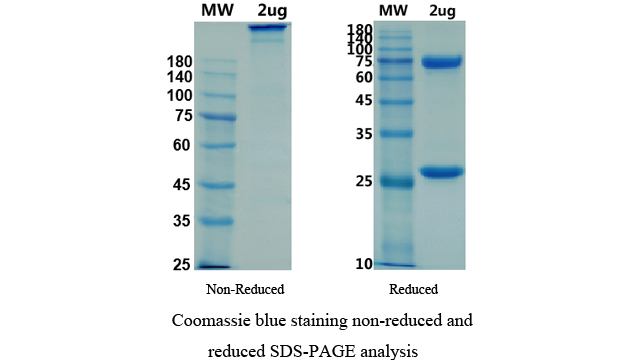[Proteogenix] Anti-2019-nCoV(S1)-1 IgM antibody