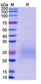 [Proteogenix] Recombinant Monkeypox virus/MPXV M1R Protein