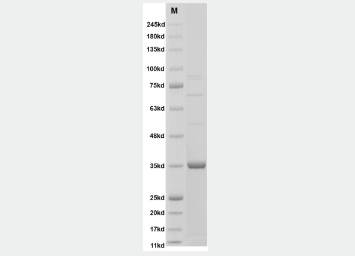 [Creative Diagnostics] Recombinant Human Metapneumovirus Matrix Protein