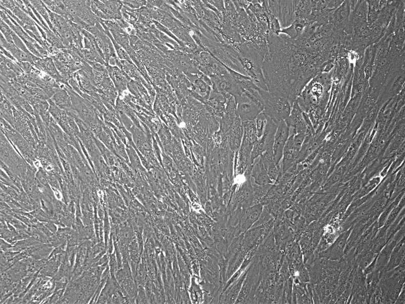 [Virto Biopharma] Human Bone Marrow Derived Mesenchymal Stem Cells (MSCs): 500,000 Cells