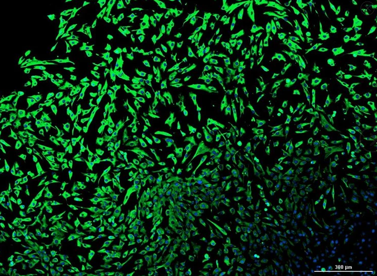 [Vitro Biopharma] Human Head & Neck Squamous Cell Carcinoma Cancer-Associated Fibroblasts (CAFs): 1,000,000 Cells