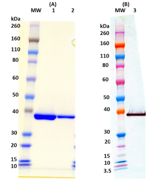 [IBT Bioservices] Recombinant S. aureus LukS-PV (His-tagged, N-terminus)