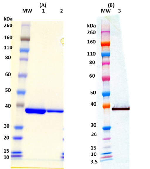 [IBT Bioservices] S. aureus LukF-PV (His-tag, C-terminus)