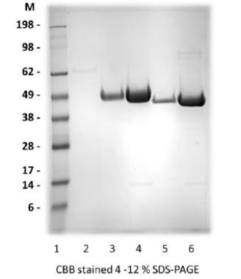 [IBT Bioservices] Zika Virus Ev2-monomer Protein