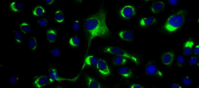 [IBT Bioservices] Anti-Dengue Virus Antibody, DE1