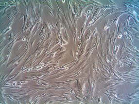 [Neuromics] CAF Growth Media