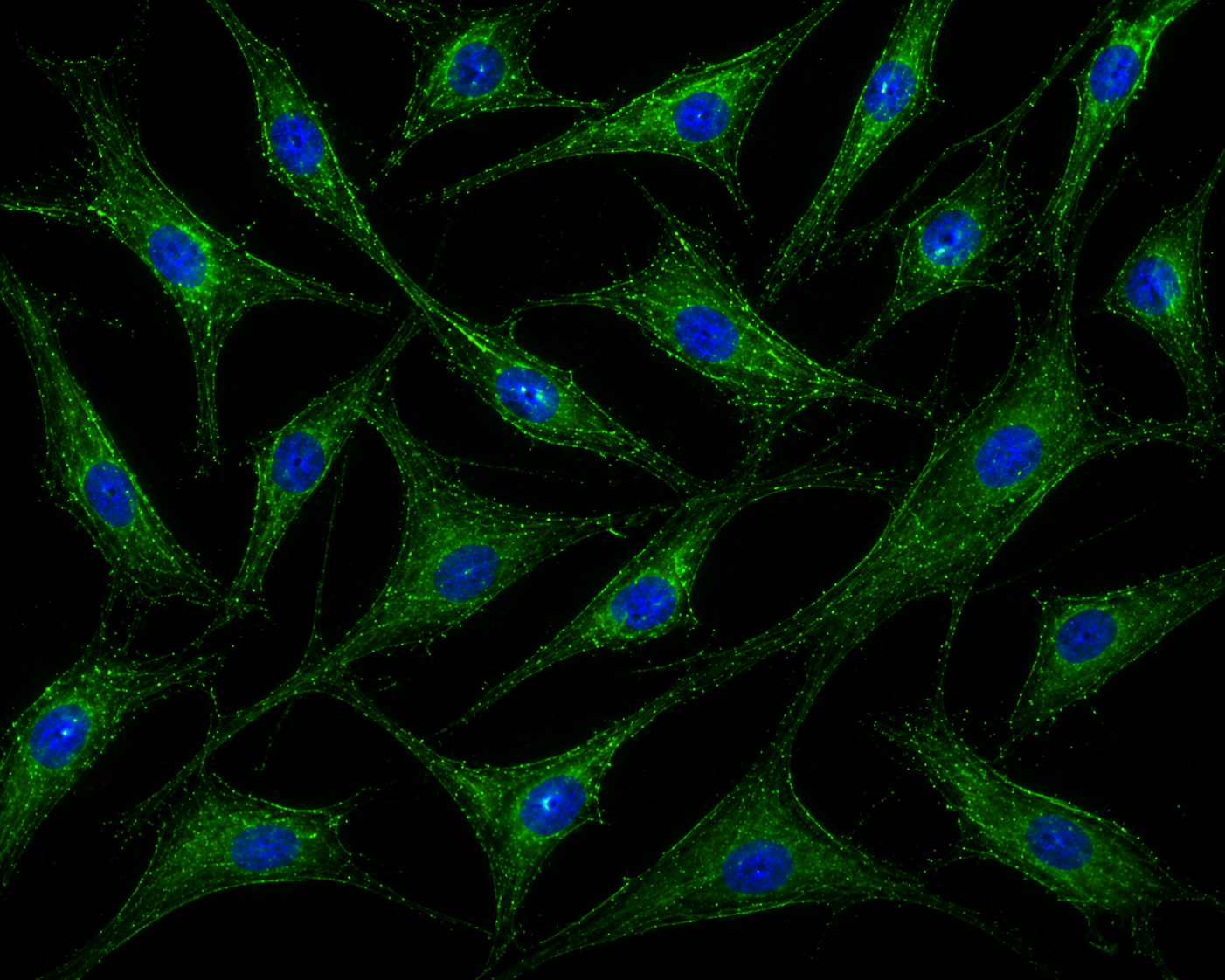 [NeoBioPharma] ACE2-GFP Expressing Human Pulmonary Artery Endothelial Cells