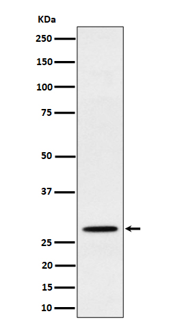 [Genscript] PSMB10 Antibody, mAb, Rabbit