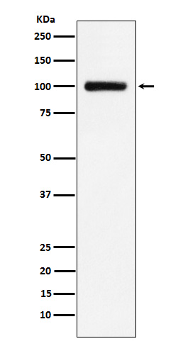 [Genscript] Transferrin receptor 2 Antibody, mAb, Rabbit