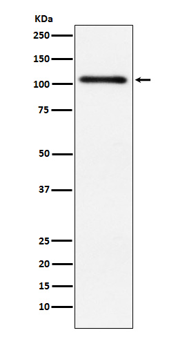 [Genscript] PKD2 Antibody, mAb, Rabbit