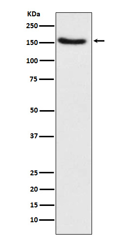 [Genscript] Hamartin Antibody, mAb, Rabbit