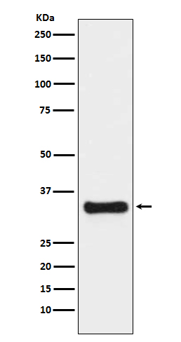 [Genscript] Thymidylate synthase Antibody, mAb, Rabbit