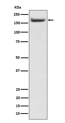 [Gensript] Insulin receptor substrate 2 Antibody, mAb, Rabbit