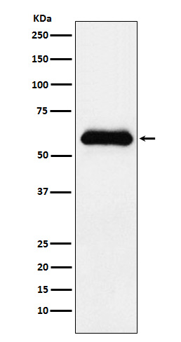 [Genscript] alpha 1 Antichymotrypsin Antibody, mAb, Rabbit