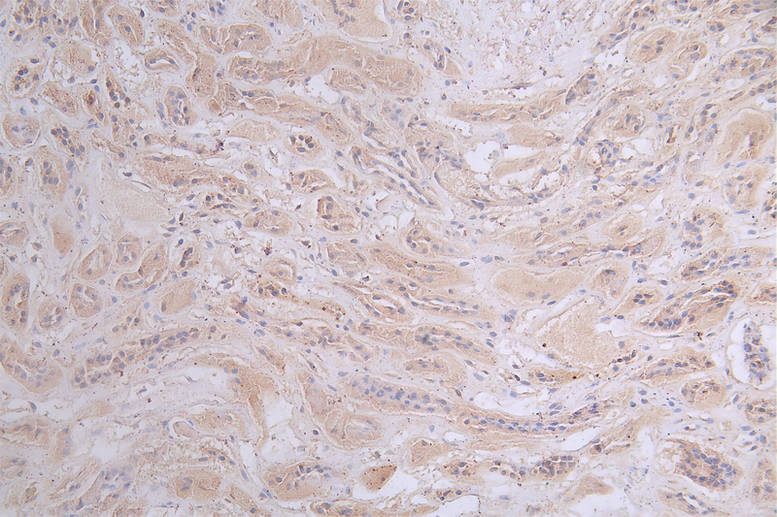 [CUSABIO] PRKAR2A Recombinant Monoclonal Antibody