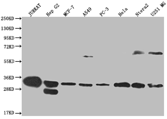 [CUSABIO] PSME1 Recombinant Monoclonal Antibody