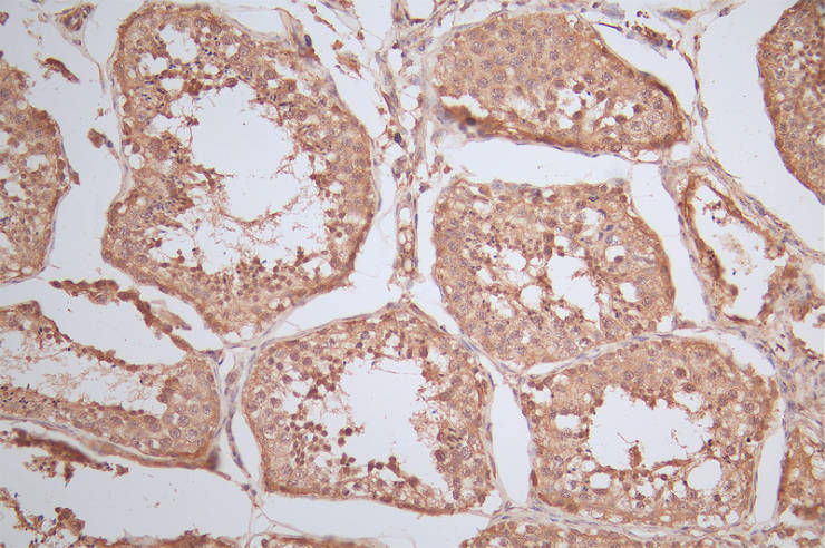 [CUSABIO] RAN Recombinant Monoclonal Antibody