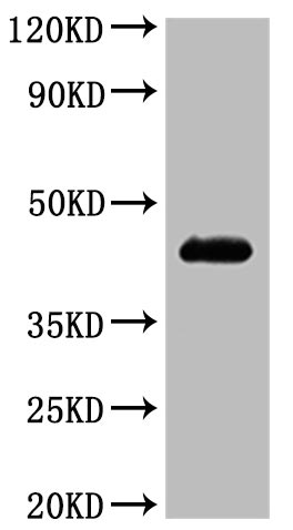 [CUSABIO] Recombinant Human C-C chemokine receptor type 4 (CCR4)-VLPs (Active)