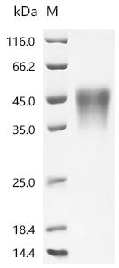 [CUSABIO] Recombinant Human Low affinity immunoglobulin gamma Fc region receptor III-A (FCGR3A), partial (Active)