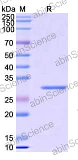 [Abinscience] Human IL11 Recombinant Protein (N-His-SUMO)