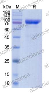 [Abinscience] Human FAP Recombinant Protein (C-His)