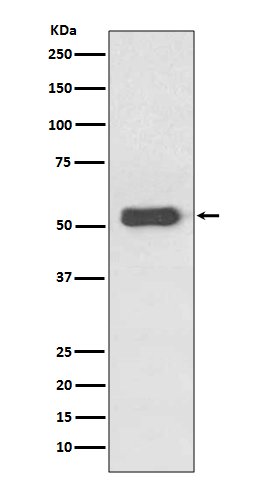 [Genscript] Estrogen receptor beta Antibody, mAb, Rabbit