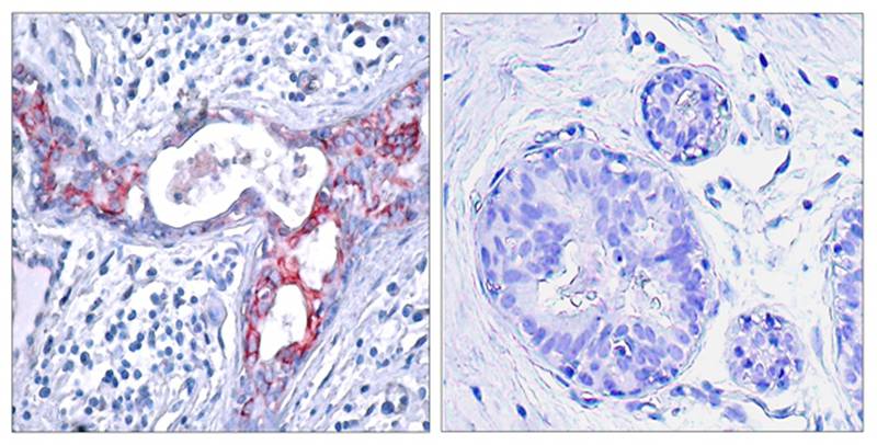[Signalway Antibody] GSK3β(Phospho-Ser9) Antibody