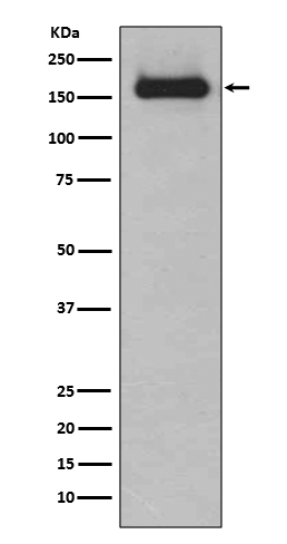 [Genscript] HDAC9 Antibody, mAb, Rabbit