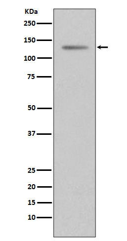 [Genscript] Progesterone receptor Antibody, mAb, Rabbit