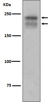 [Genscript] VEGF Receptor 2 Antibody, mAb, Rabbit