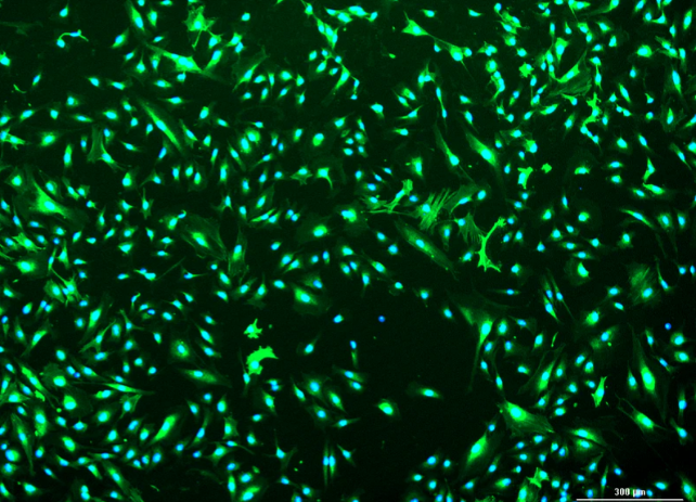 [Vitro Biopharma] Human Prostate Carcinoma Cancer-Associated Fibroblasts (CAFs): 1,000,000 Cells