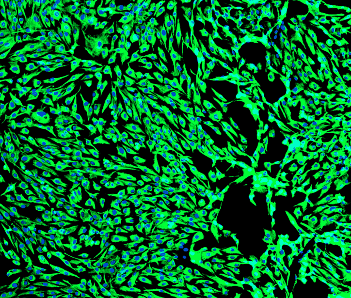 [Vitro Biopharma] Human Gastric Cancer-Associated Fibroblasts (CAFs): 1,000,000 Cells