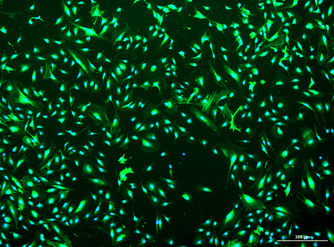 [Vitro BioPharma] Human Prostate Carcinoma Cancer-Associated Fibroblasts (CAFs): 1,000,000 Cells