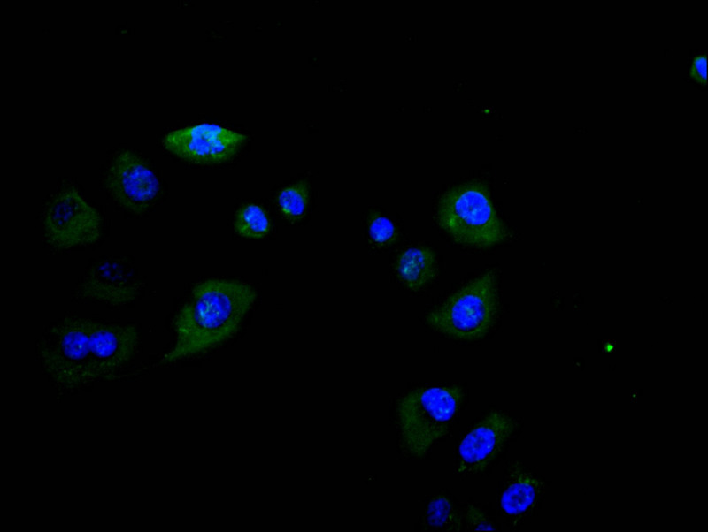 [Cusabio] FCGR3A Recombinant Monoclonal Antibody