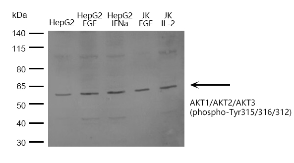 AKT1/AKT2/AKT3(phospho-Tyr315/316/312) Antibody - SAB | Signalway Antibody
