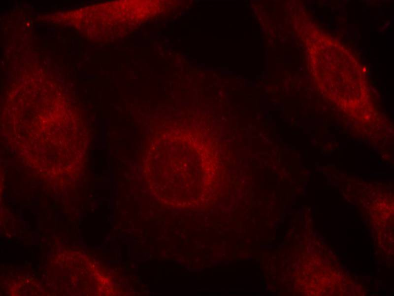 AKT1/AKT2/AKT3(phospho-Tyr315/316/312) Antibody - SAB | Signalway Antibody