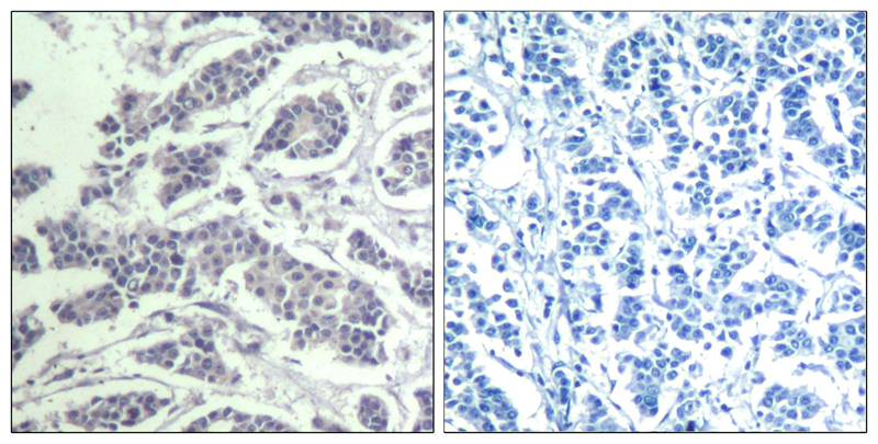 AKT1/AKT2/AKT3(phospho-Tyr315/316/312) Antibody - SAB | Signalway Antibody