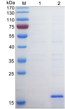 SDS-PAGE PRRSV-2 N
